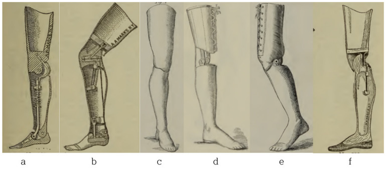 Prosthetics, Medicine, and Disability in Modern America: The Case of the A. A. Marks Artificial Limb Company.