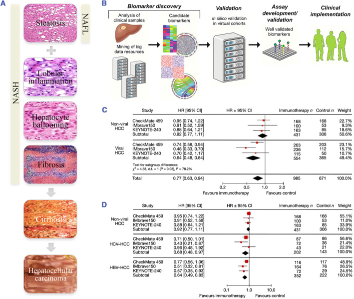 Multidimensional landscape of non-alcoholic fatty liver disease-related disease spectrum uncovered by big omics data: Profiling evidence and new perspectives.