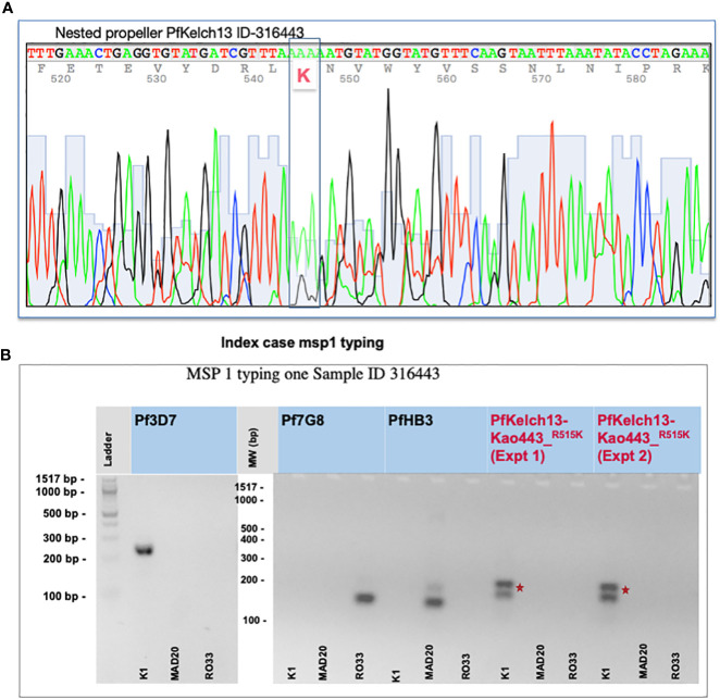 Identification of an <i>in vitro</i> artemisinin-resistant <i>Plasmodium falciparum</i> kelch13 R515K mutant parasite in Senegal.