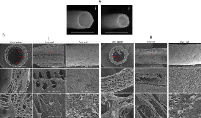 Longitudinally aligned inner-patterned silk fibroin conduits for peripheral nerve regeneration.