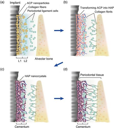 Cementum is key to periodontal tissue regeneration: A review on apatite microstructures for creation of novel cementum-based dental implants