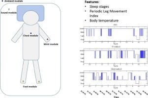 Evaluation of a Wireless Home Sleep Monitoring System Compared to Polysomnography