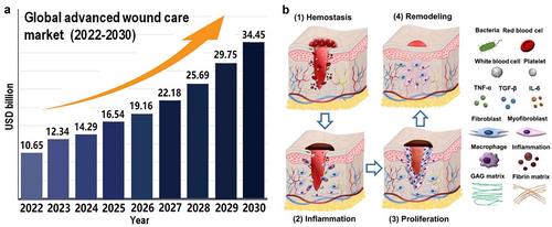 Responsive hydrogel dressings for intelligent wound management