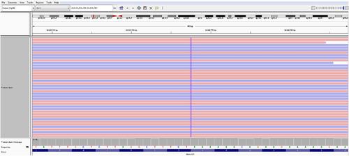 DNAJC21-related thrombocytopenia in a young adult female