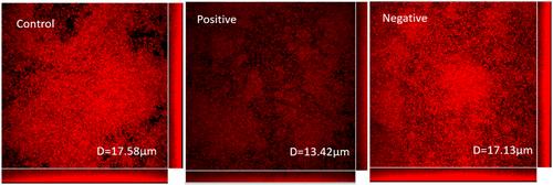 Electret prevents the formation of bacterial biofilm