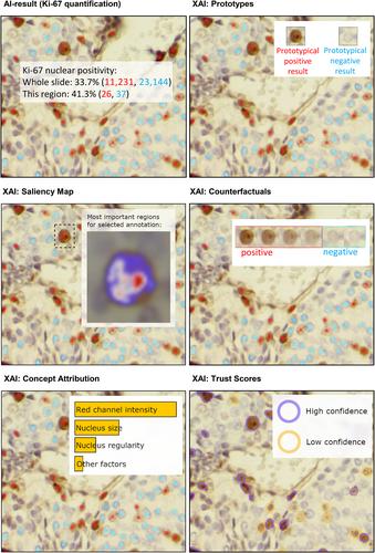 Explainability and causability in digital pathology