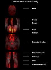 Recent technical developments and clinical research applications of sodium (23Na) MRI