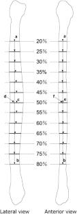 Fibular diaphyseal curvature of the Jomon population