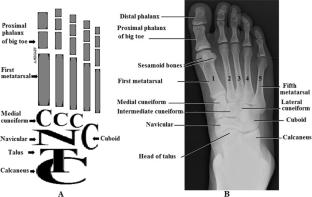 Talus bone: normal anatomy, anatomical variations and clinical correlations