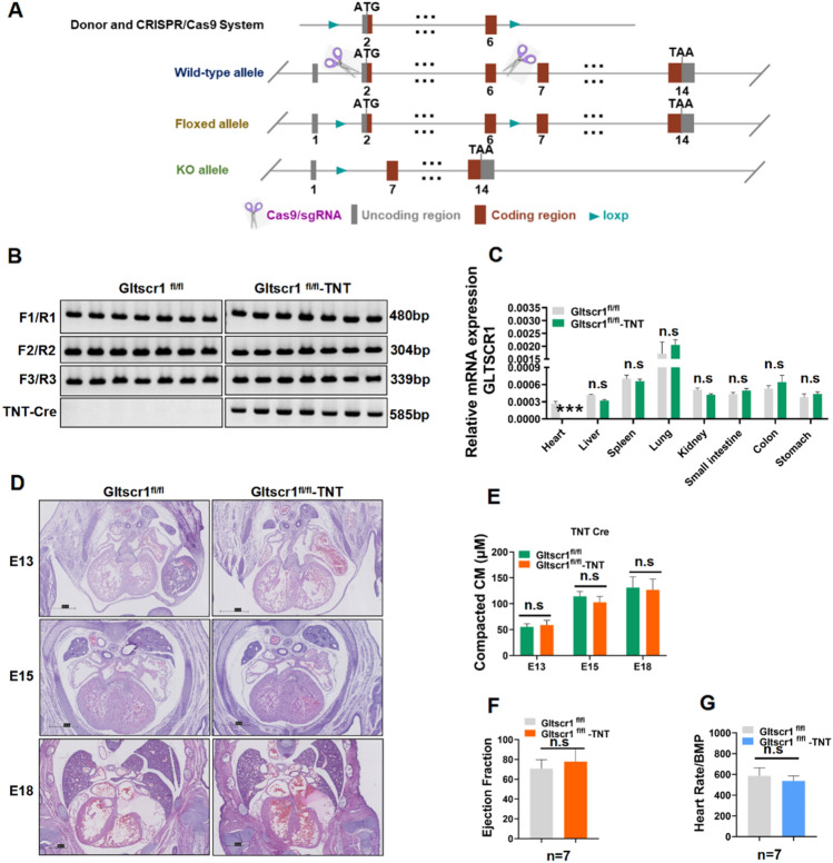 Loss of GLTSCR1 causes congenital heart defects by regulating NPPA transcription