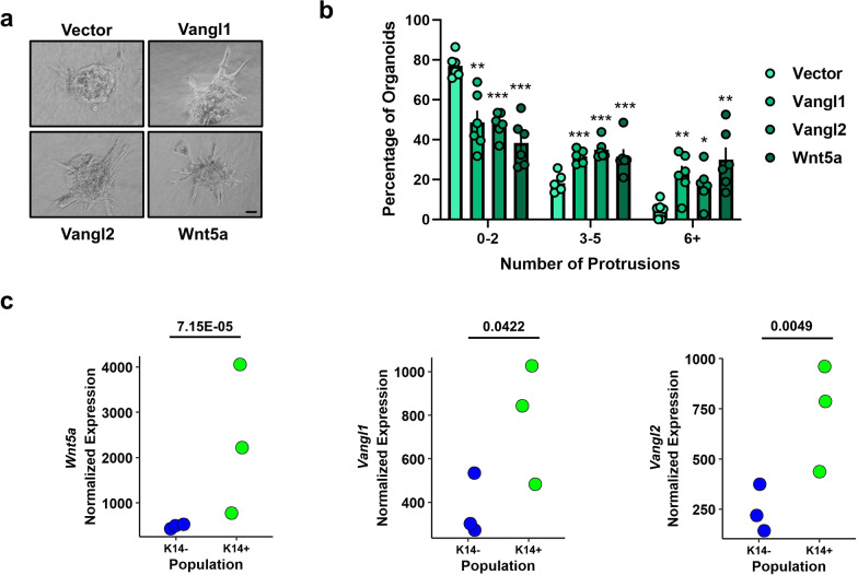 Vangl-dependent Wnt/planar cell polarity signaling mediates collective breast carcinoma motility and distant metastasis.