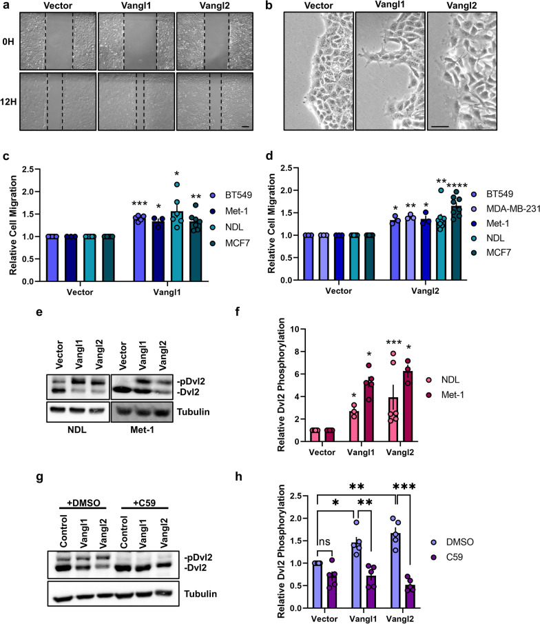 Vangl-dependent Wnt/planar cell polarity signaling mediates collective breast carcinoma motility and distant metastasis.