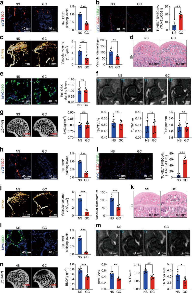 FAR591 promotes the pathogenesis and progression of SONFH by regulating Fos expression to mediate the apoptosis of bone microvascular endothelial cells.