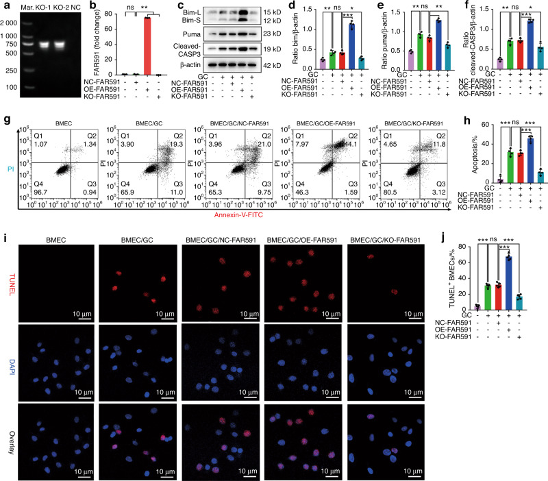 FAR591 promotes the pathogenesis and progression of SONFH by regulating Fos expression to mediate the apoptosis of bone microvascular endothelial cells.