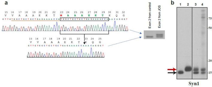 New SNCA mutation and structures of α-synuclein filaments from juvenile-onset synucleinopathy