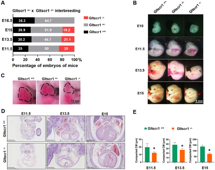 Loss of GLTSCR1 causes congenital heart defects by regulating NPPA transcription