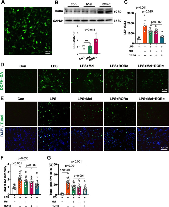 Cardiac-targeted delivery of nuclear receptor RORα via ultrasound targeted microbubble destruction optimizes the benefits of regular dose of melatonin on sepsis-induced cardiomyopathy.