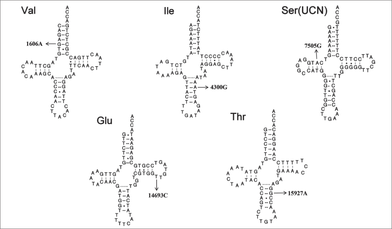 Analysis of Mitochondrial Transfer RNA Mutations in Breast Cancer.