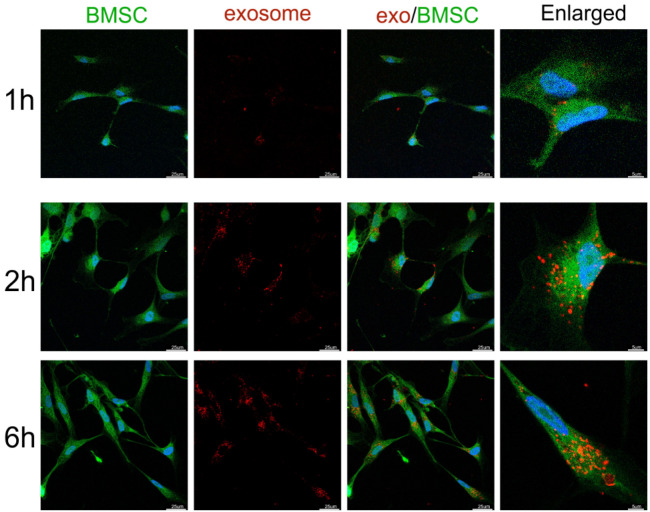 Exosomes from Tension Force-Applied Periodontal Ligament Cells Promote Mesenchymal Stem Cell Recruitment by Altering microRNA Profiles.