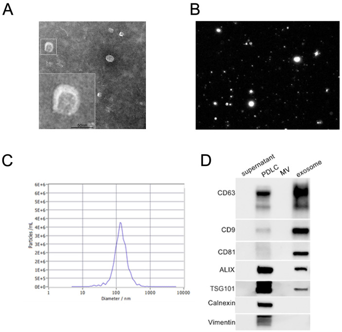 Exosomes from Tension Force-Applied Periodontal Ligament Cells Promote Mesenchymal Stem Cell Recruitment by Altering microRNA Profiles.