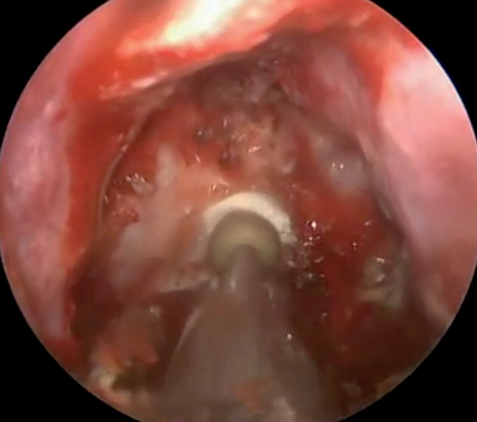 [Diagnosis and new treatment options for pituitary adenomas].