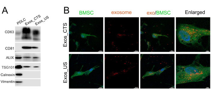 Exosomes from Tension Force-Applied Periodontal Ligament Cells Promote Mesenchymal Stem Cell Recruitment by Altering microRNA Profiles.