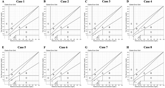 Safety and Accuracy of Professional Continuous Glucose Monitoring in Patients Undergoing Allogeneic Hematopoietic Stem Cell Transplantation.