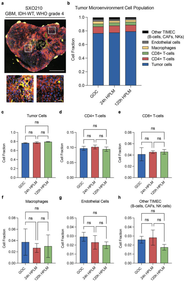 Stable isotope tracing in human plasma-like medium reveals metabolic and immune modulation of the glioblastoma microenvironment.