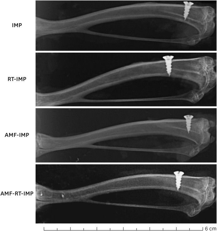 Radioprotective role of amifostine on osteointegration of titanium implants in the tibia of rats.