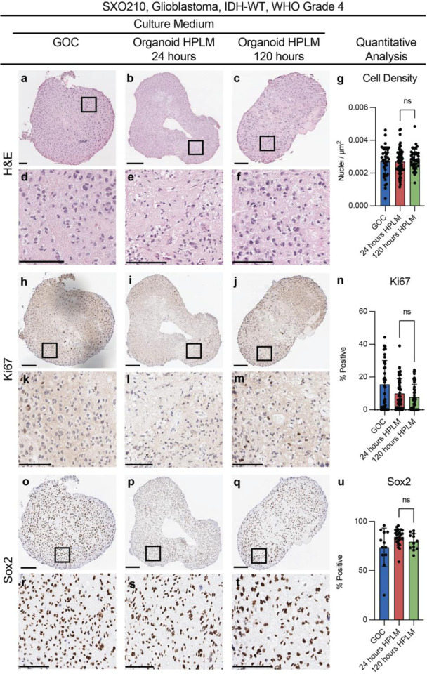 Stable isotope tracing in human plasma-like medium reveals metabolic and immune modulation of the glioblastoma microenvironment.