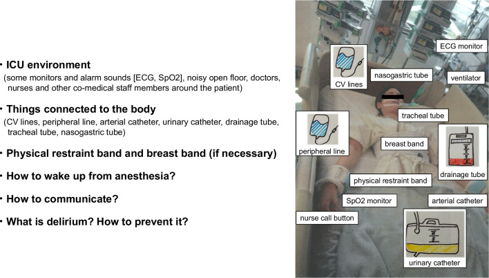 The impact of a preoperative nurse-led orientation program on postoperative delirium after cardiovascular surgery: a retrospective single-center observational study.