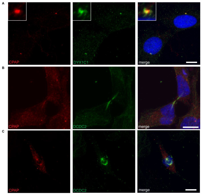 Genetic and protein interaction studies between the ciliary dyslexia candidate genes DYX1C1 and DCDC2.