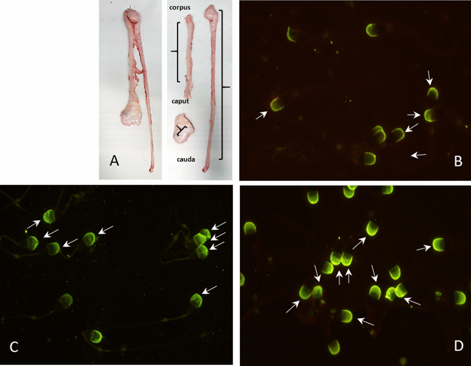 CpG DNA methylation changes during epididymal sperm maturation in bulls.