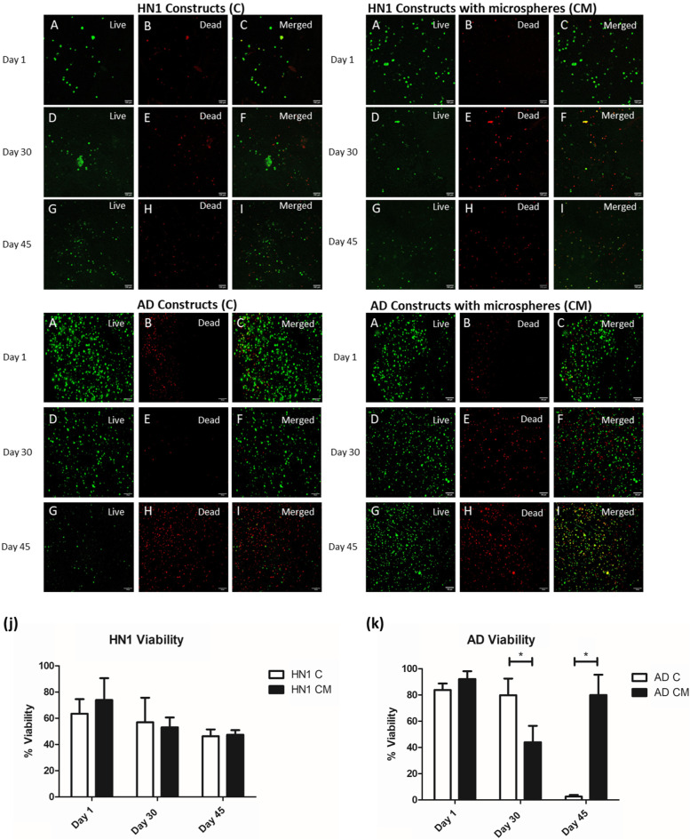 3D bioprinting patient-derived induced pluripotent stem cell models of Alzheimer's disease using a smart bioink.