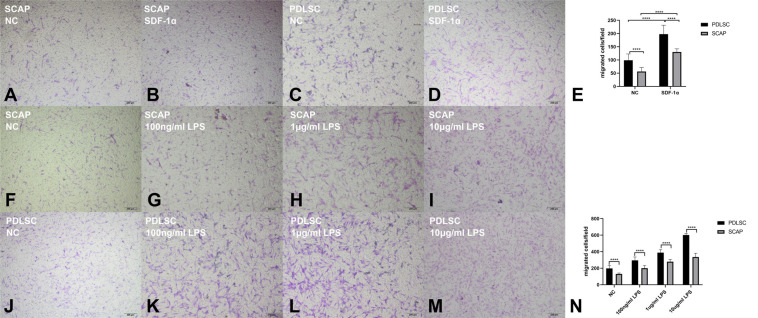 The Role of SDF-1α-CXCR4/CXCR7 in Migration of Human Periodontal Ligament Stem Cells.