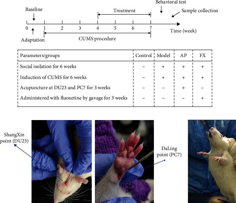 Acupuncture Alleviates CUMS-Induced Depression-Like Behaviors by Restoring Prefrontal Cortex Neuroplasticity.