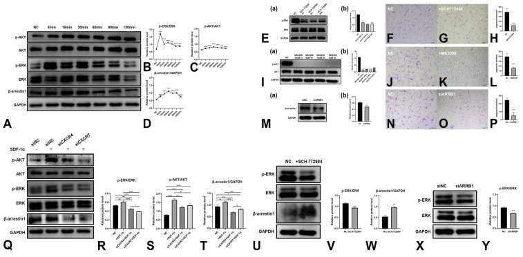 The Role of SDF-1α-CXCR4/CXCR7 in Migration of Human Periodontal Ligament Stem Cells.