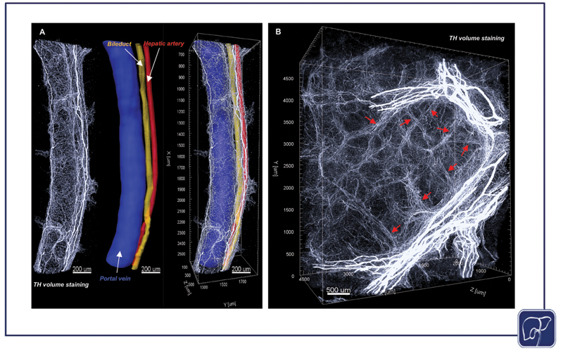 Hepatic Innervations and Nonalcoholic Fatty Liver Disease.