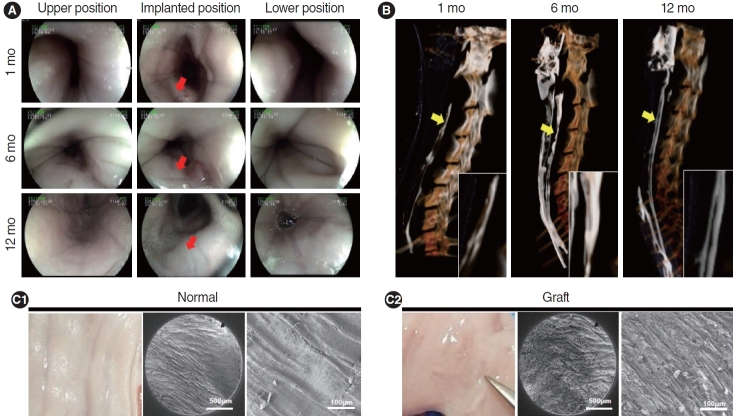 Assessment of Esophageal Reconstruction via Bioreactor Cultivation of a Synthetic Scaffold in a Canine Model.