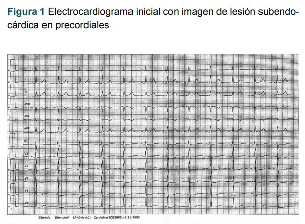 [Acute coronary syndrome provoked by a coronary intramural hematoma].