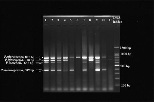 Simultaneous detection and evaluation of <i>Prevotella intermedia, Prevotella nigrescens, Prevotella loescheii</i>, and <i>Prevotella melaninogenica</i> in subgingival plaque samples of chronic periodontitis and healthy individuals through multiplex polymerase chain reaction.