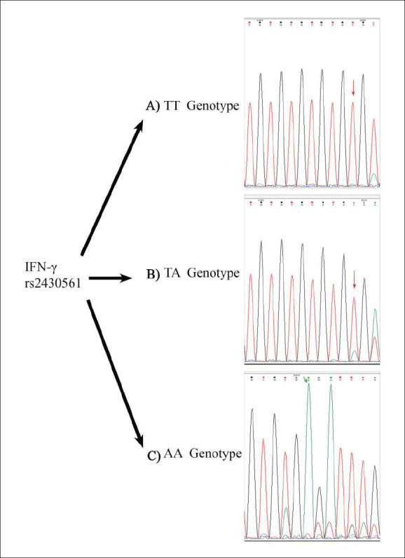 Demographic, clinical and genetic factors associated with COVID-19 disease susceptibility and mortality in a Kurdish population.