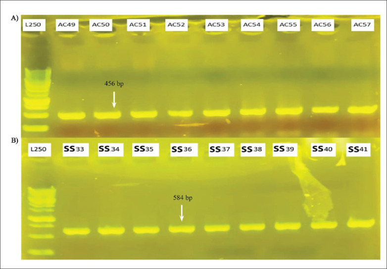 Demographic, clinical and genetic factors associated with COVID-19 disease susceptibility and mortality in a Kurdish population.