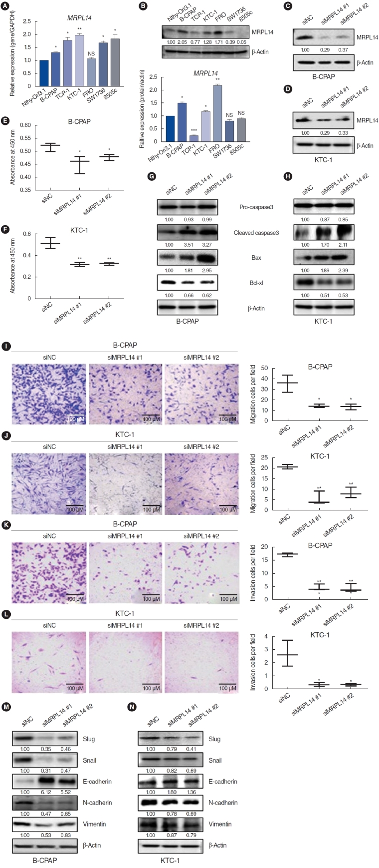 Mitochondrial Ribosomal Protein L14 Promotes Cell Growth and Invasion by Modulating Reactive Oxygen Species in Thyroid Cancer.