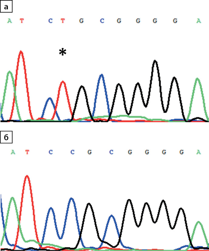 [Clinical and laboratory characteristics of arginine vasopressin resistance, caused by a new homozygous mutation p.R113C in AQP2].