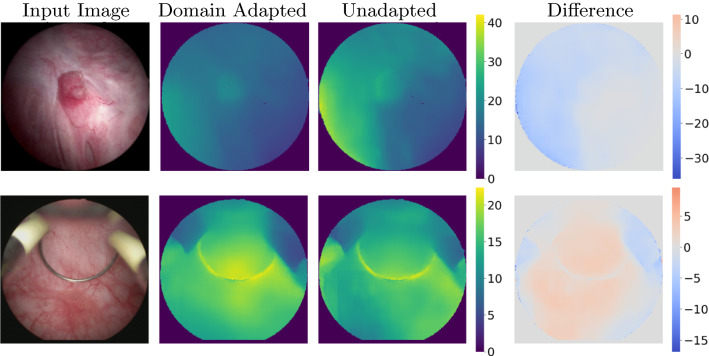 Cystoscopic depth estimation using gated adversarial domain adaptation.