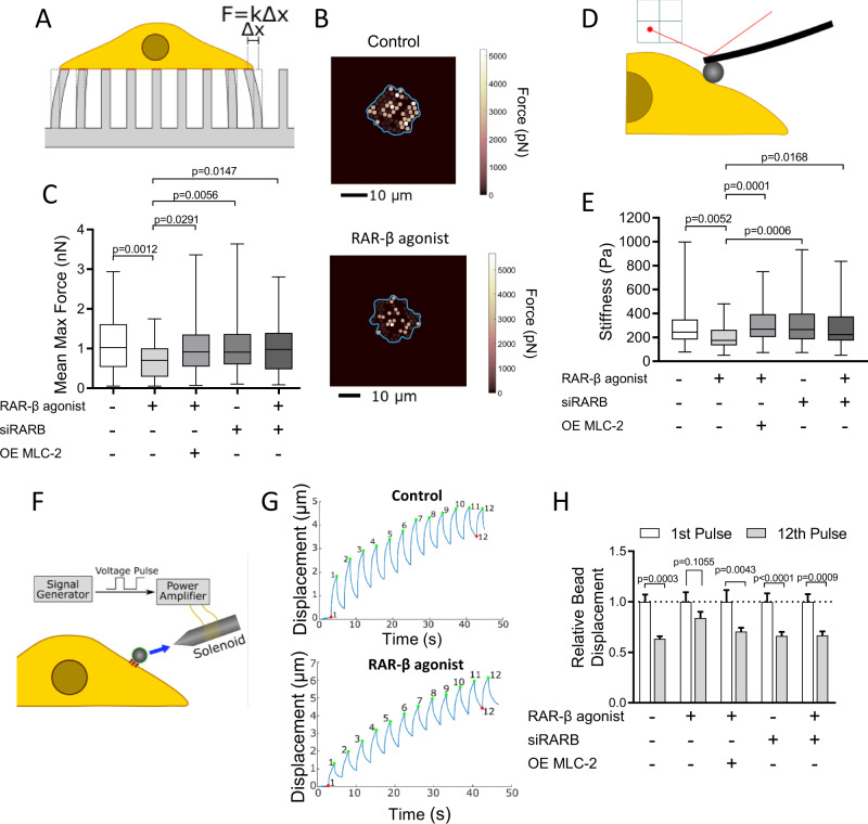 Retinoic acid receptor β modulates mechanosensing and invasion in pancreatic cancer cells via myosin light chain 2.