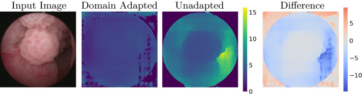 Cystoscopic depth estimation using gated adversarial domain adaptation.