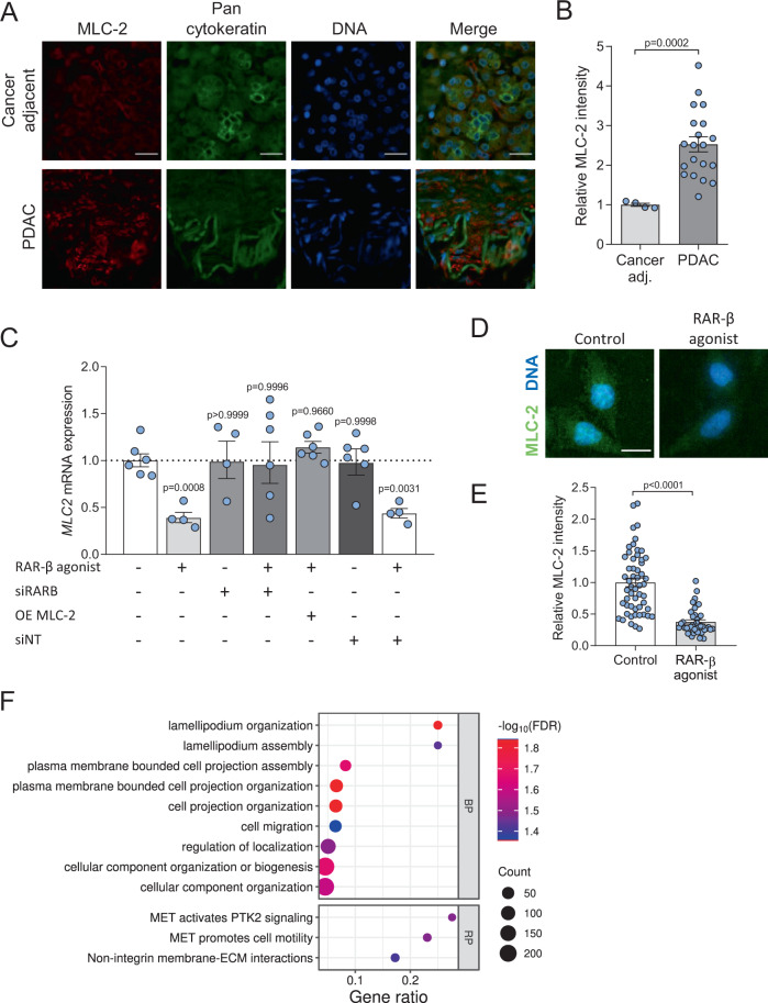 Retinoic acid receptor β modulates mechanosensing and invasion in pancreatic cancer cells via myosin light chain 2.