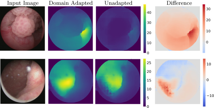 Cystoscopic depth estimation using gated adversarial domain adaptation.